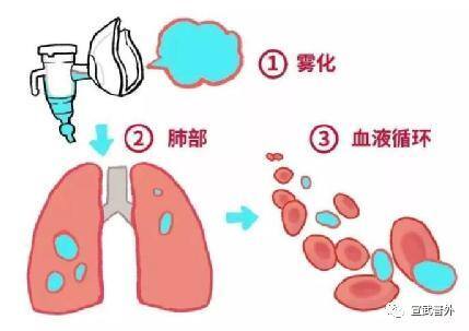 怎么做的（手术后为什么要做雾化吸入？）