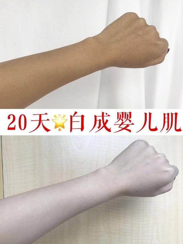 变白的最快最有效的方法学生党（20天黑黄皮逆袭，黄一白）