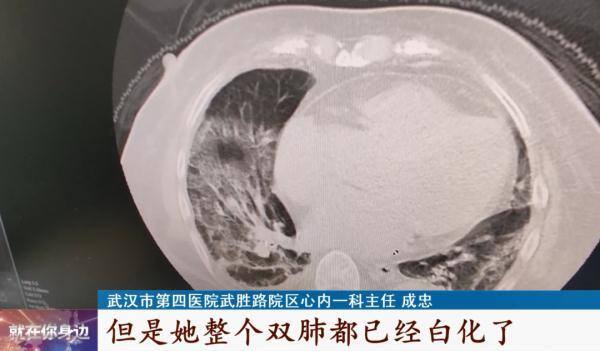儿子27岁就是不上班怎么办（12岁男孩感染“白肺”）