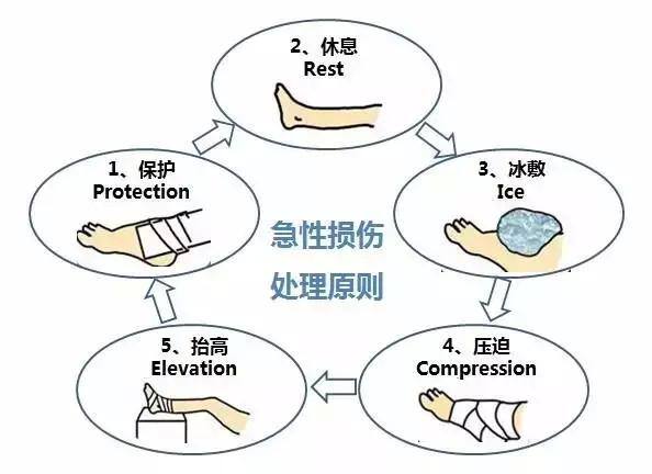 脚崴了可是必须要上班怎么办（关于崴脚的小知识）