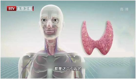 什么食物消肿最快最有效（水肿是怎么回事？）