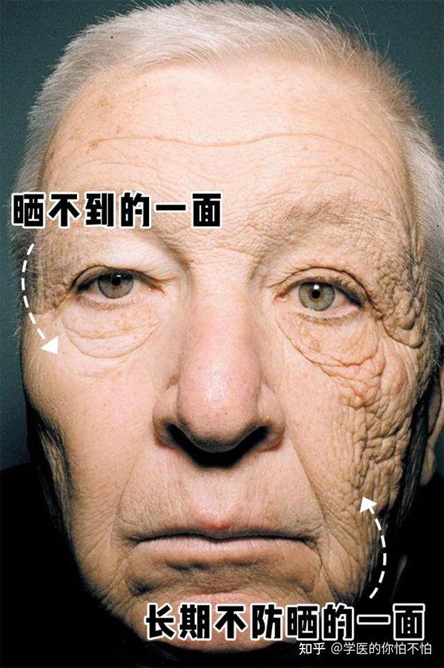 学生党如何美白脸部最快方法（如何快速变白？特别是脸）