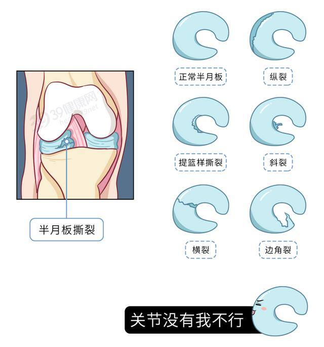 宫腔积液做什么运动最好排出（如何保护膝关节）