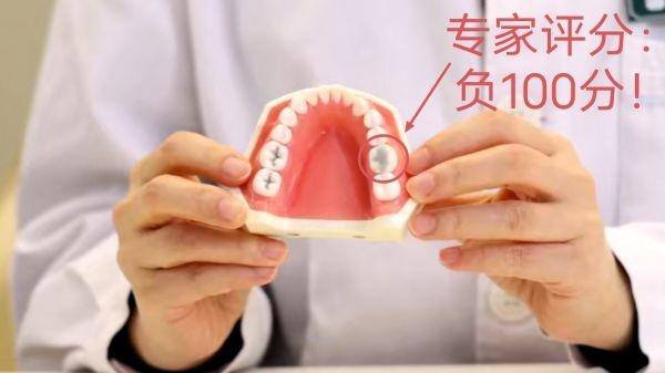 自己在家（“diy”补牙大风险）